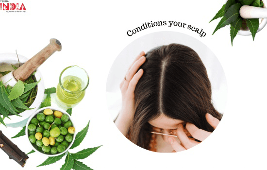 Hair Benefits of neem