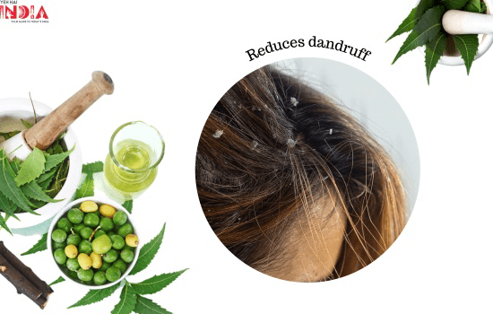 Neem Reduces dandruff