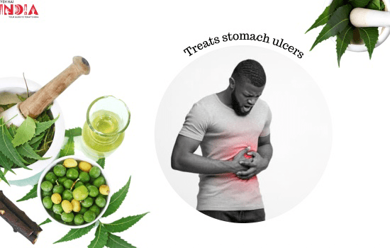 Neem Treats stomach ulcers