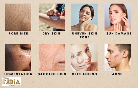 Skin Benefits of Glycolic Acid