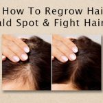 Regrow Hair On Bald Spot _ Fight Hair loss
