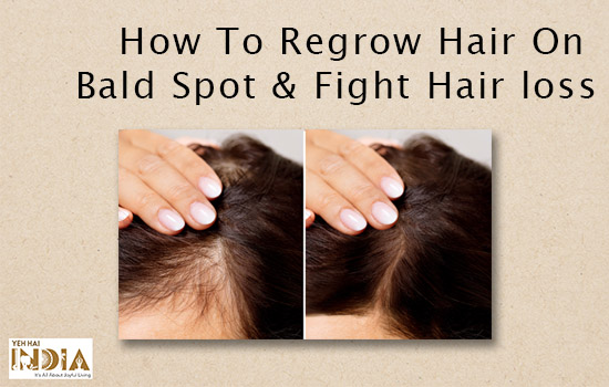 How To Regrow Hair On Bald Spot & Fight Hair loss